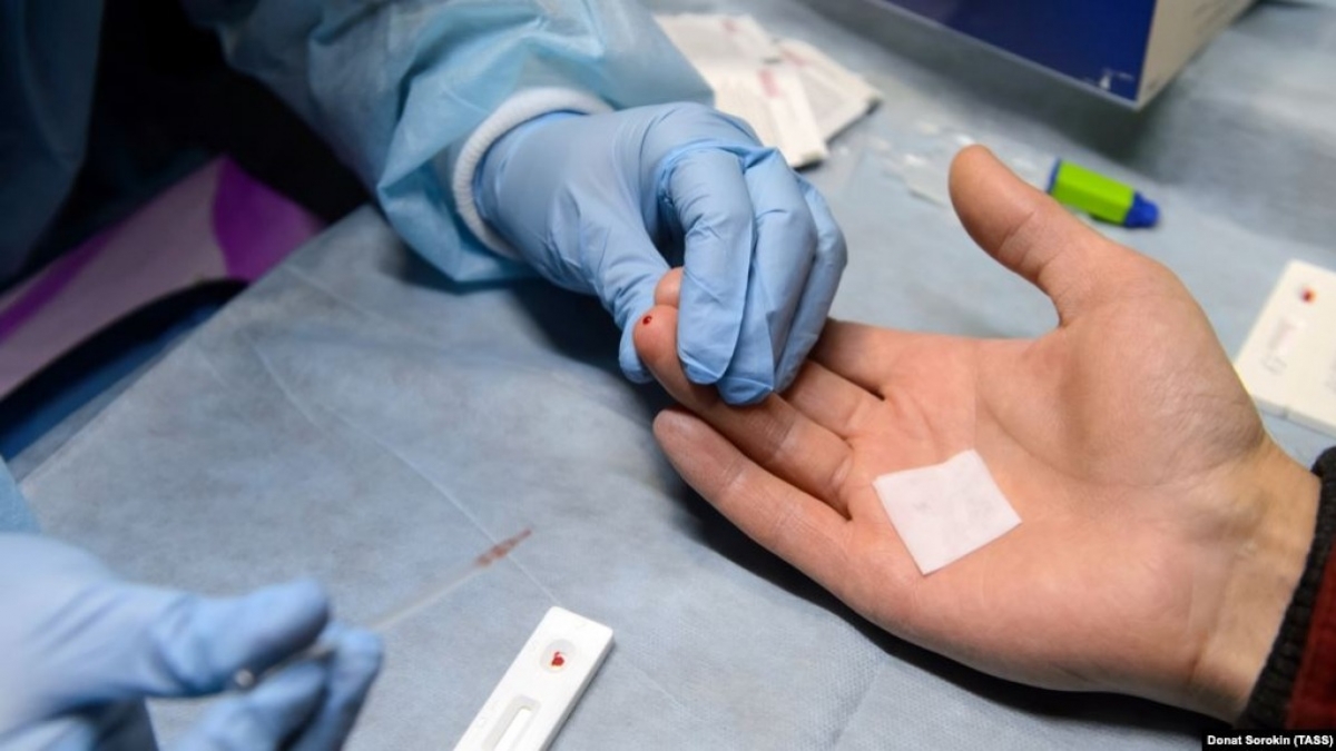 Украина переходит на новые стандарты лечения ВИЧ