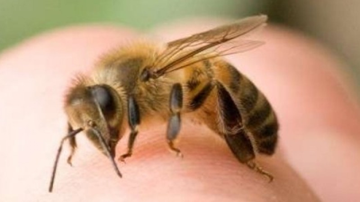 Первые действия при укусе пчелы