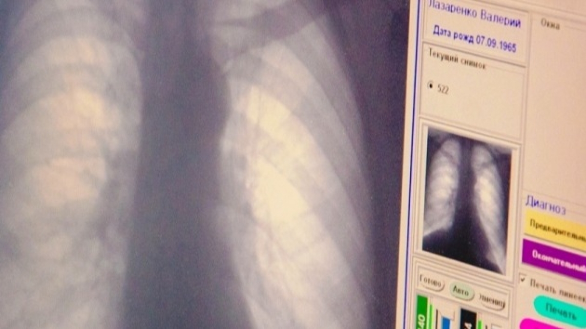 Как уберечься от туберкулеза