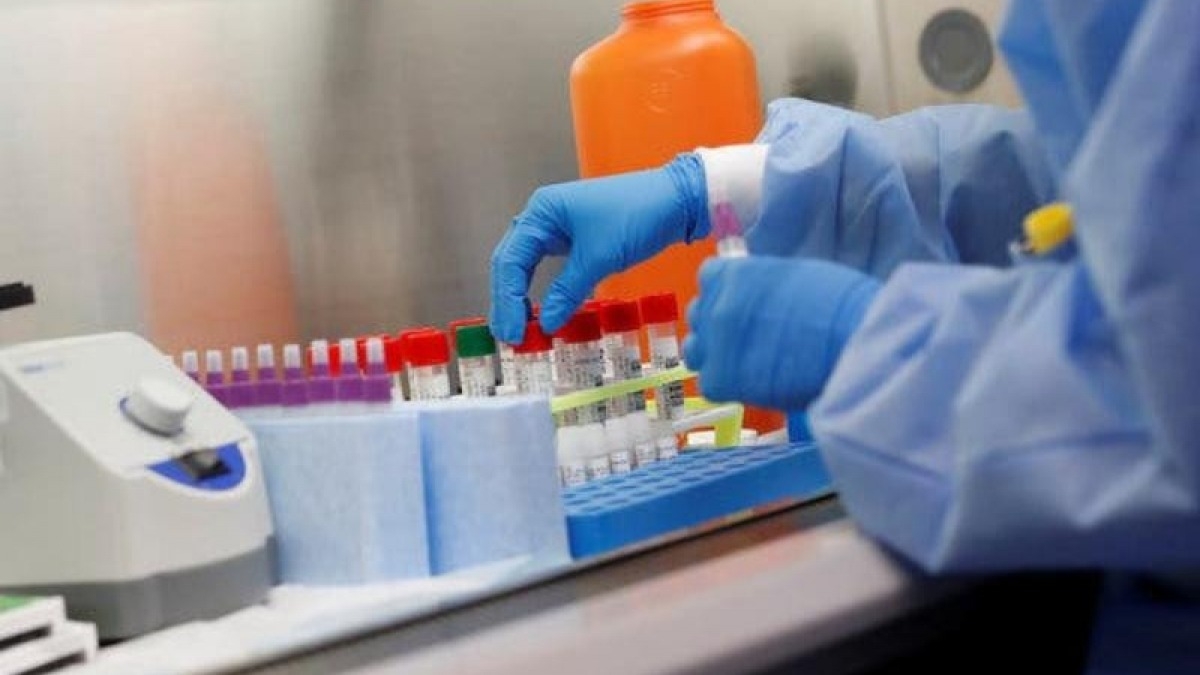 72 мобильные медицинские бригады будут проводить проверки жителей на коронавирус в области