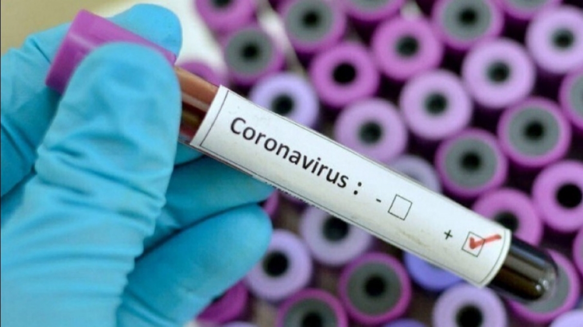 В Украине 804 человека заболели COVID-19