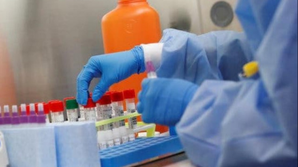 В Украине зафиксировано 942 случаев  COVID-19