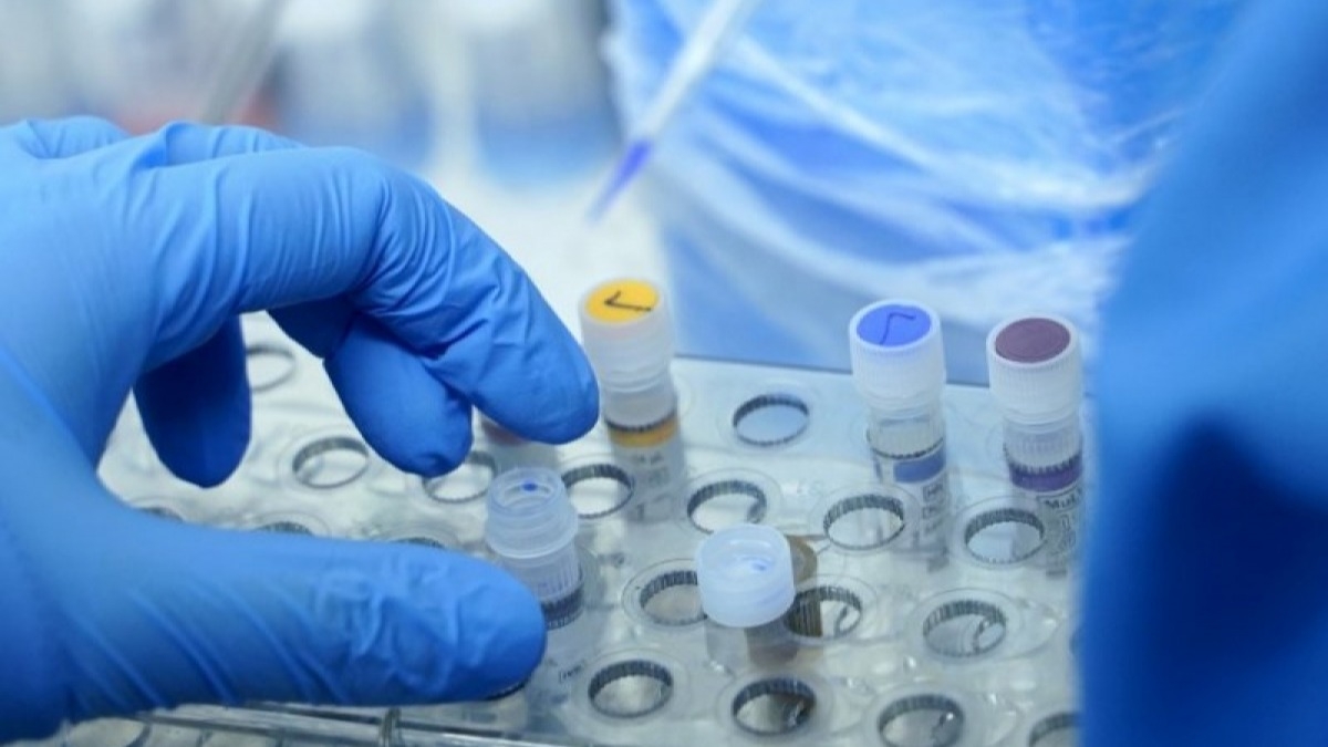 Всех больных пневмонией будут проверять на коронавирус