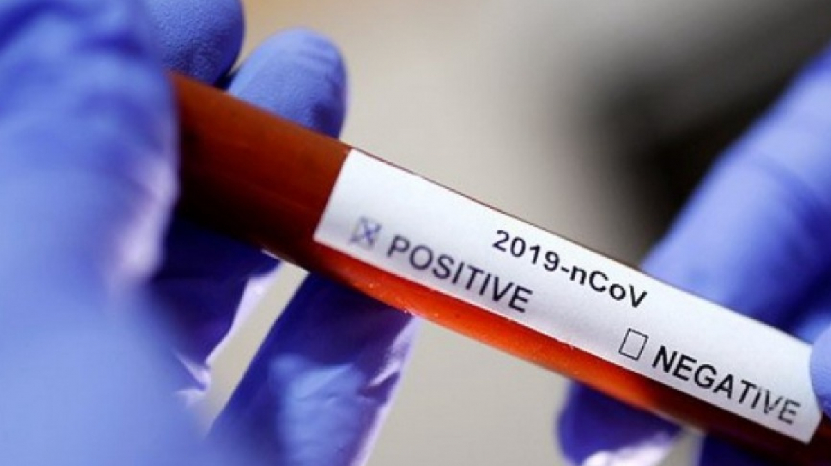 В Павлограде за сутки зафиксирован один новый случай COVID-19