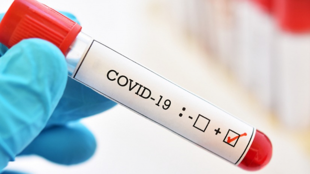 За сутки на Днепропетровщине обнаружили 7 новых случаев коронавируса