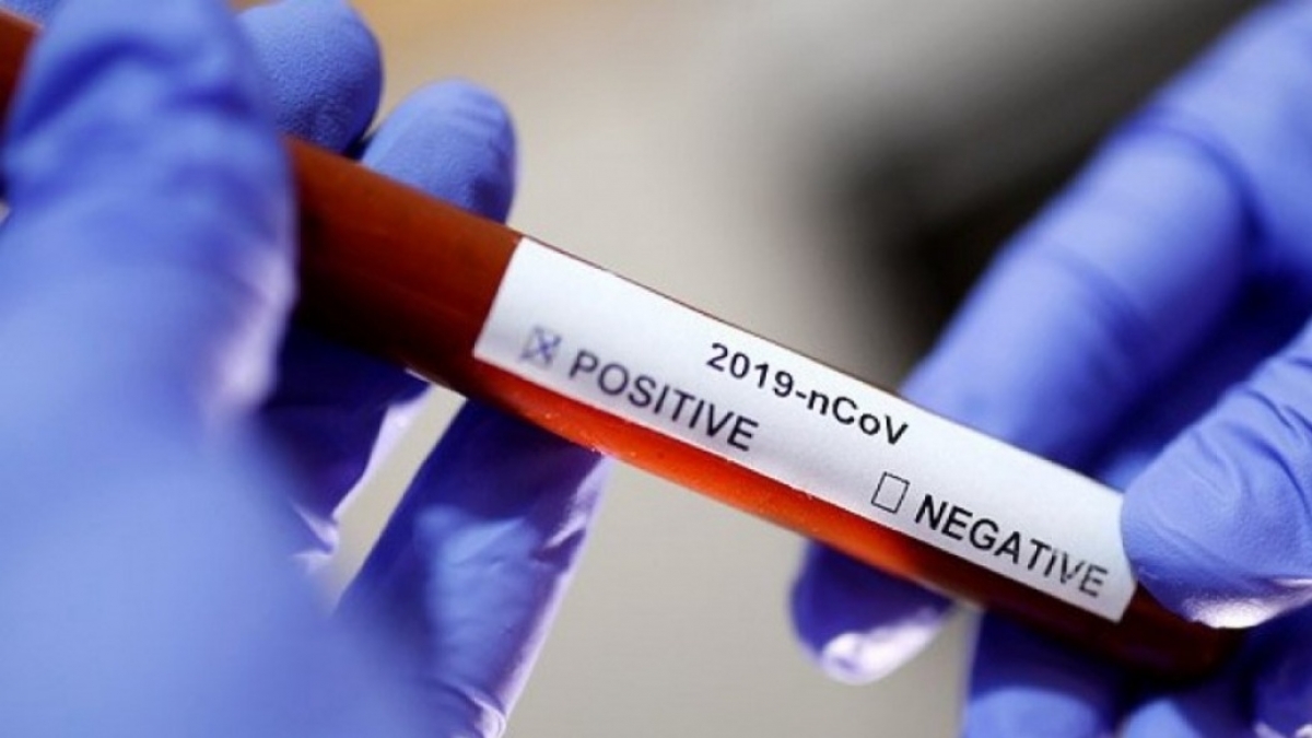   648 новых случаи инфицирования коронавирусом в Украине за сутки%d8 нових випадкі інфікування коронавірусом в Україні за добу