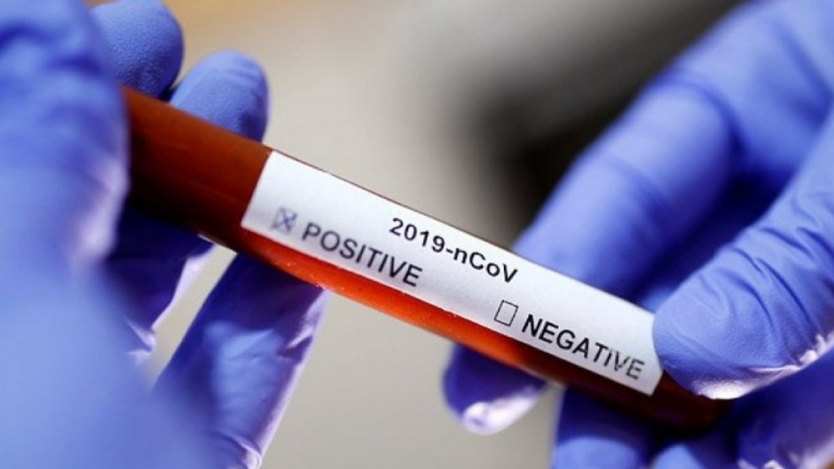 За сутки зафиксировано 681 новый случай заражения коронавирусом