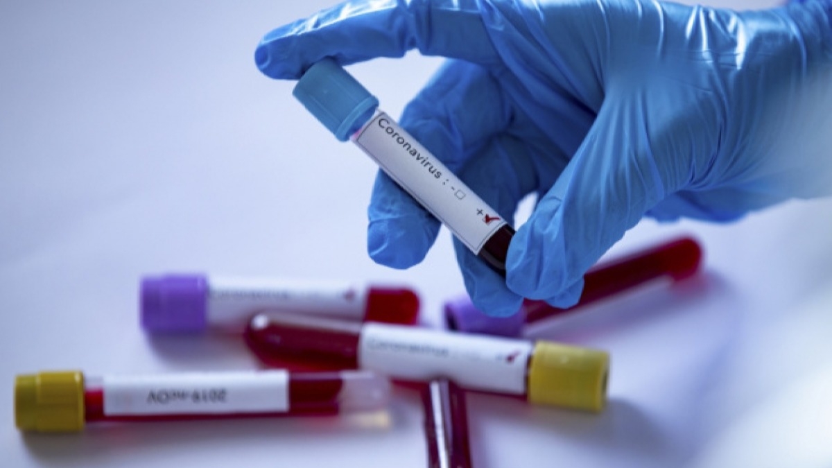 Новый антирекорд - 27 новых заболевших коронавирусом в Днепропетровской области