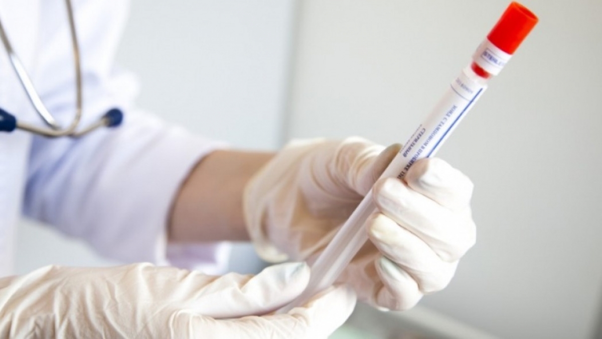 В области обнаружили 21 новый случай коронавируса