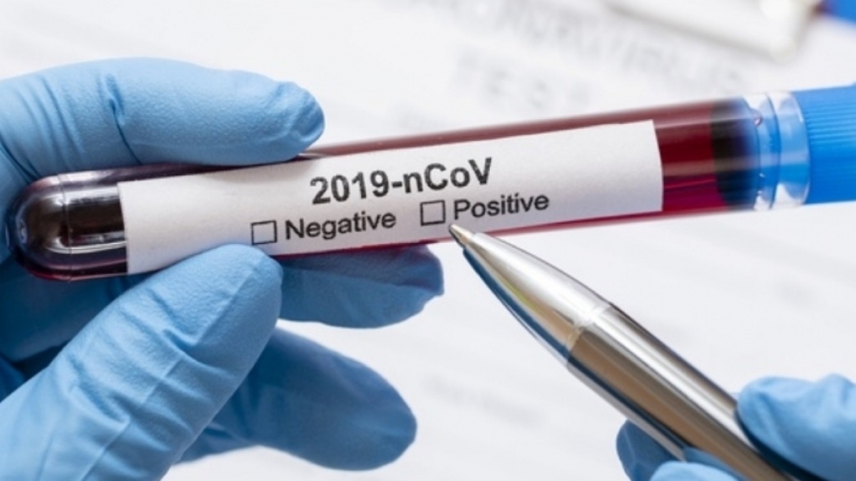 Количество инфицированных коронавирусом в Днепропетровской области, за сутки  выросло почти в 2 раза