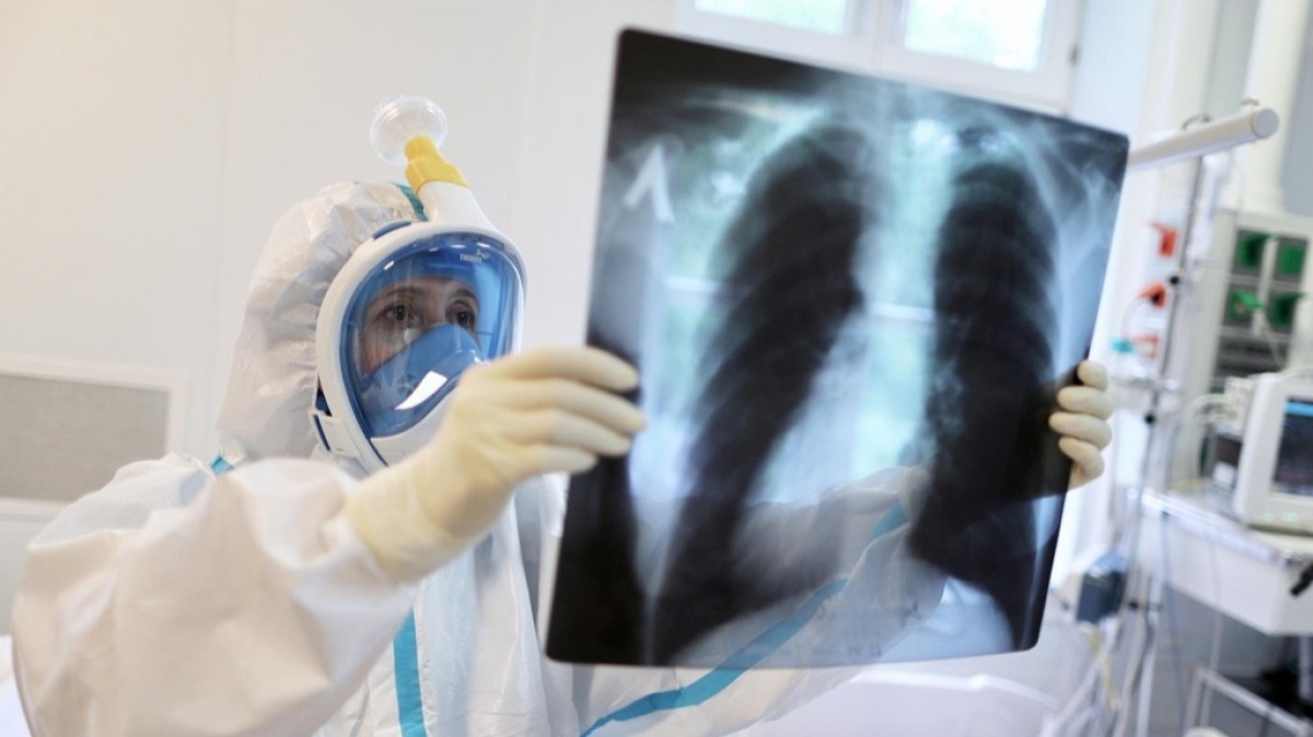 По Павлограда зафиксировано 17 новых случаев COVID-19