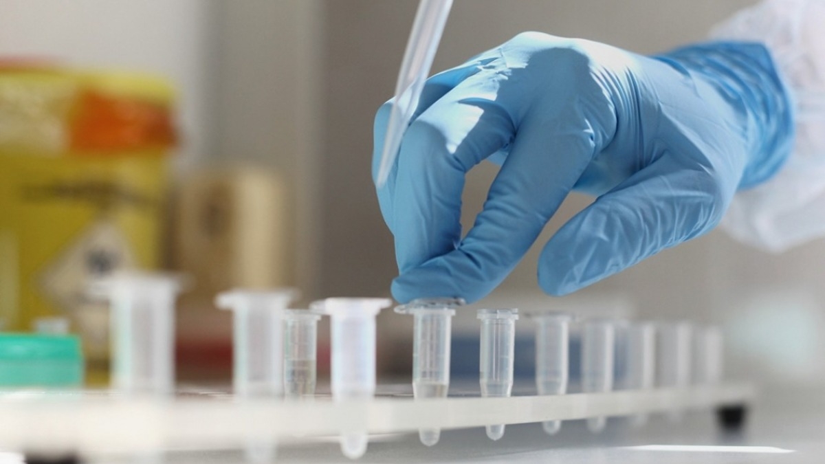 За сутки в Днепропетровской области обнаружили рекордные 497 случаев коронавируса