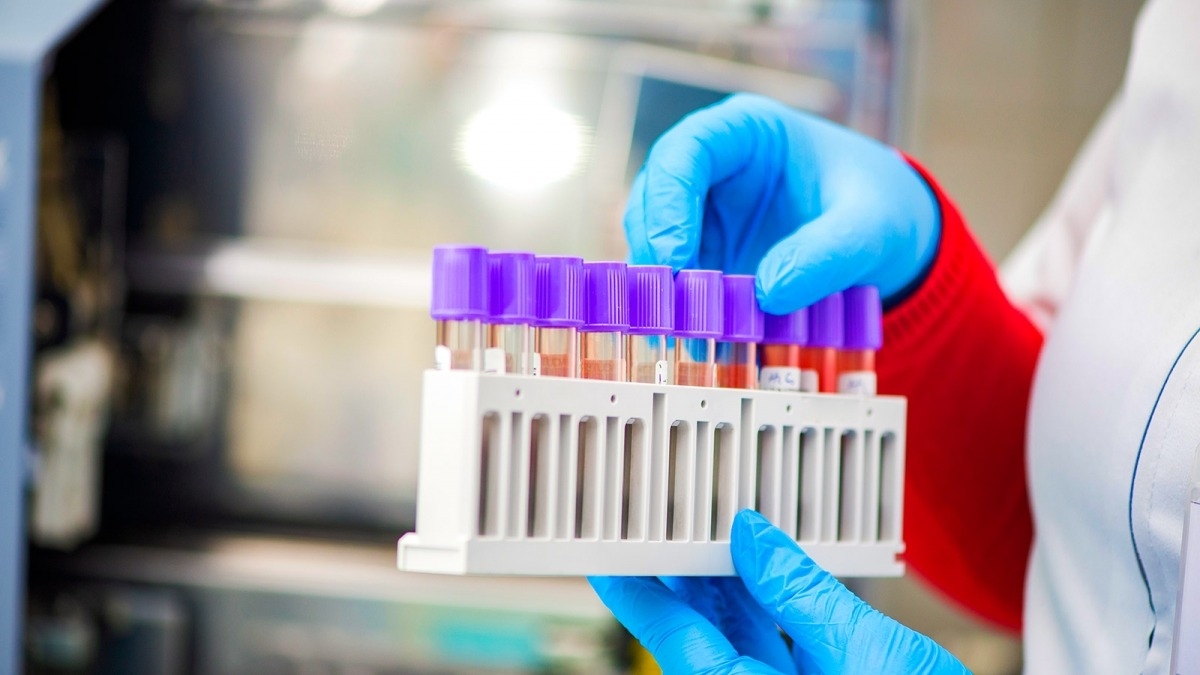 За сутки в Днепропетровской области обнаружили 808 случаев коронавируса