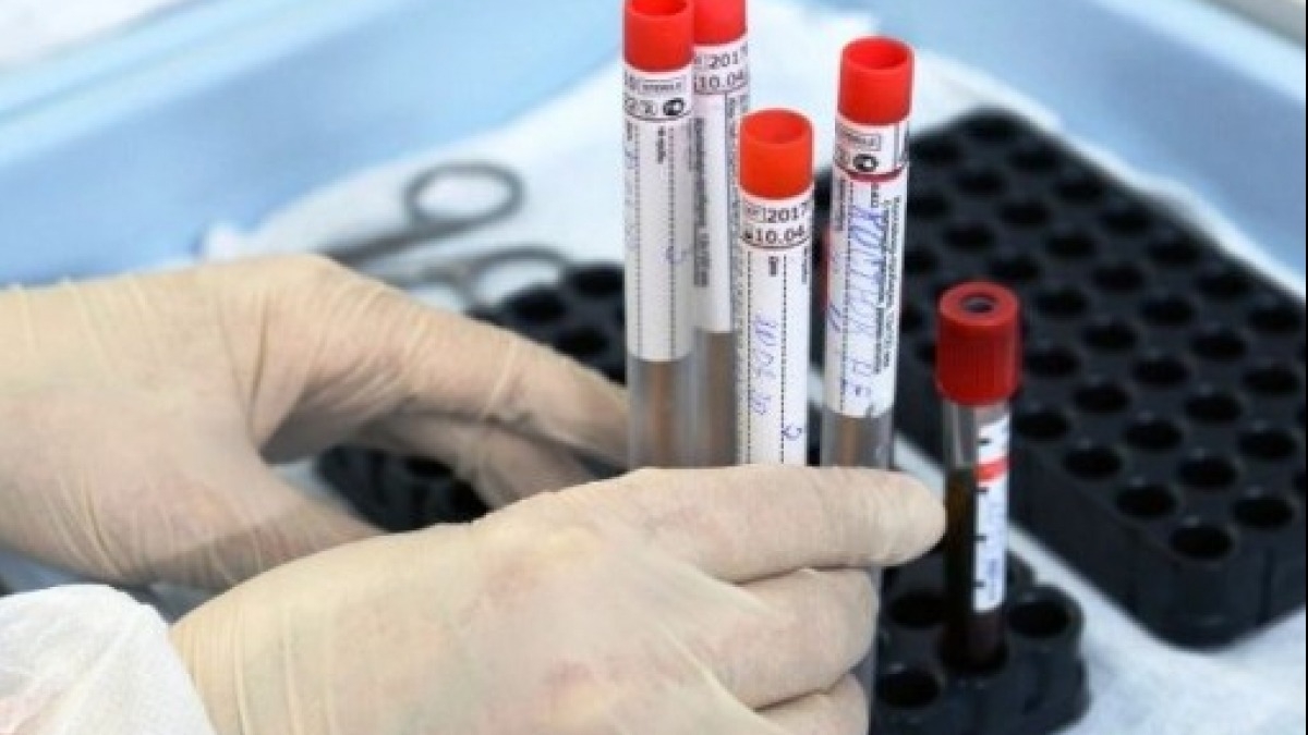 По Павлограду 49 новых случаев инфицирования COVID-19