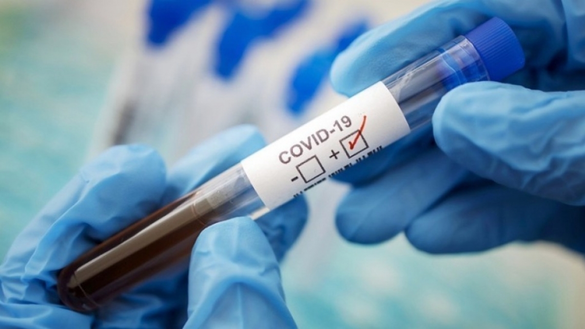 В Павлограде нет новых случаев коронавируса, на Днепропетровщине – 120