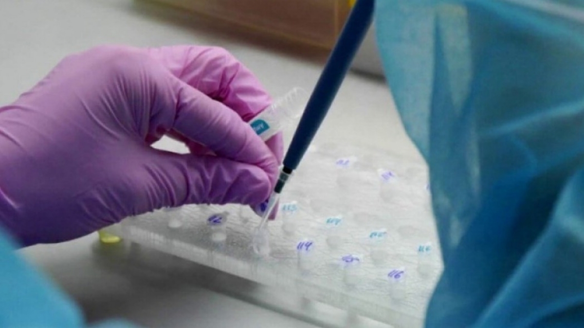 В Павлограде за сутки коронавирусом заболели сразу 25 человек