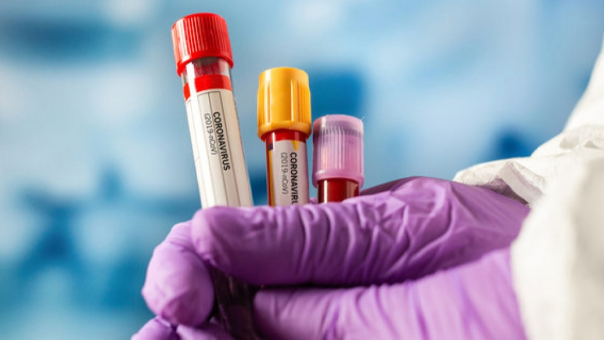 В Павлограде коронавирусом болеет почти 500 человек