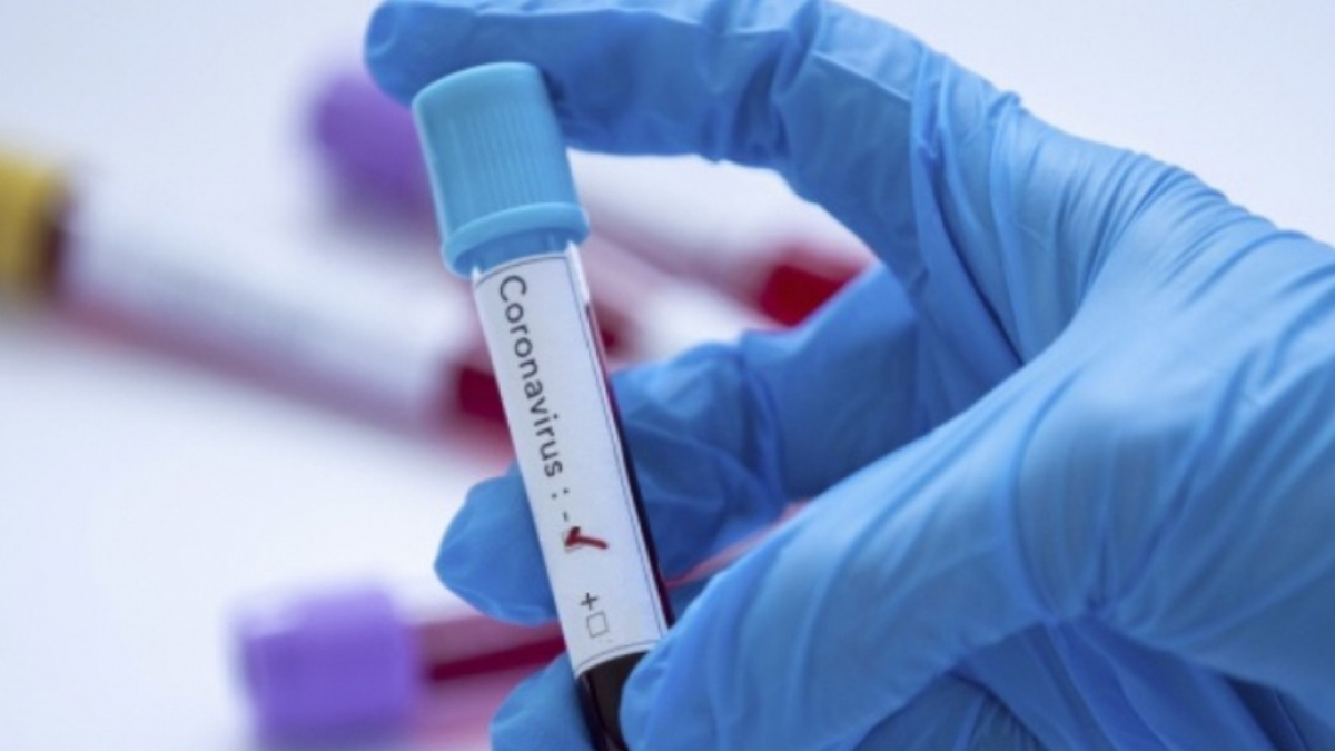 На Днепропетровщине держится высокий уровень заболеваемости коронавирусом