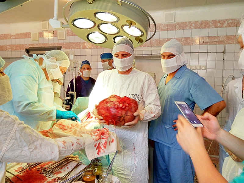 Жителю Павлоградщины провели уникальную операцию: удалили 10-килограммовую опухоль
