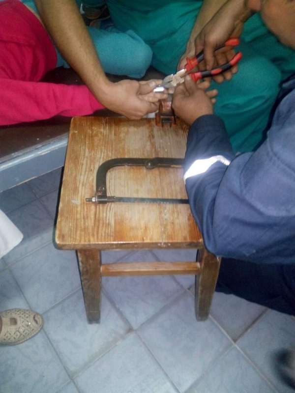 В Павлограде спасатели освободили 4х летню девочку из металлической западни