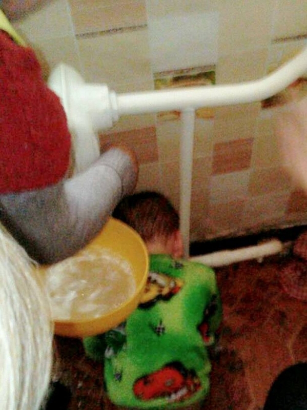 В Терновке мальчик застрял головой в батарее и получил ожог уха