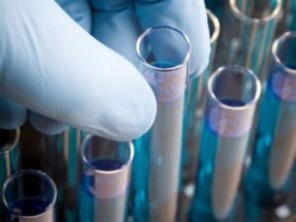 В Волчьей нашли опасных для здоровья микробов