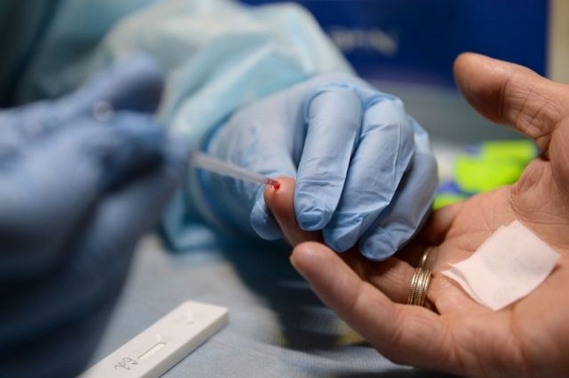 Павлоградцев приглашают пройти бесплатный экспресс-тест на ВИЧ