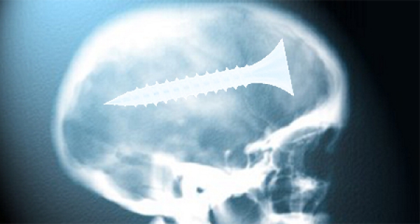 В павлоградскую больницу доставили малыша с шурупом  в голове