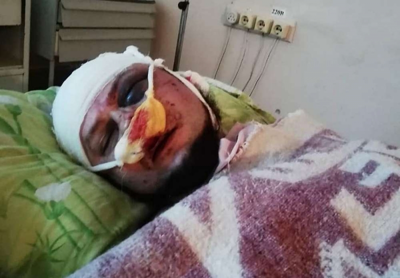 Жена жестоко избитого в Павлограде активиста сообщила номер карты, на которую можно перечислять денежную помощь